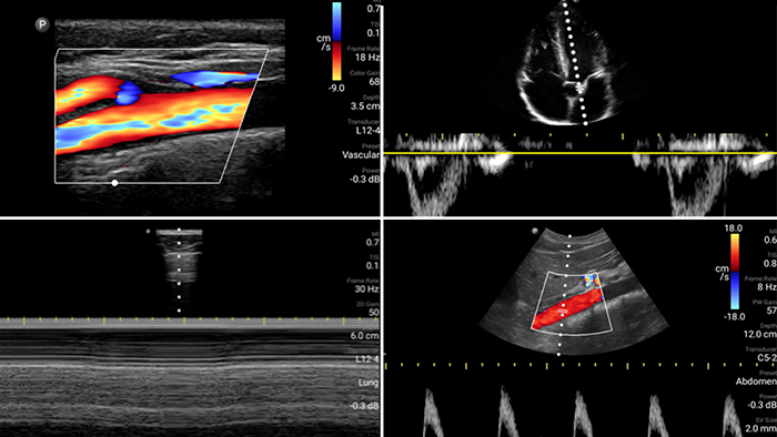 First case image